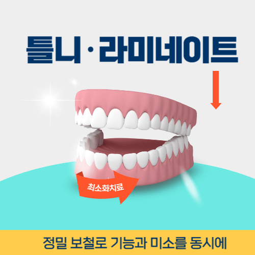 충주치과 충주시 치과 틀니 라미네이트