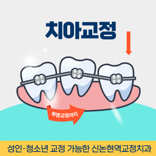 충주치과 충주시 치과 치아교정