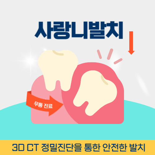 충주치과 충주시 치과 사랑니 발치