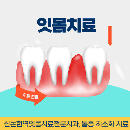 충주치과 충주시 치과 잇몸치료